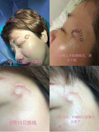 1566192143170965.png image.png